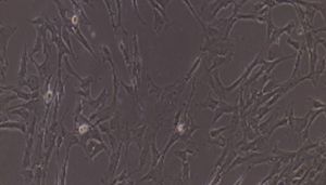 大鼠原代食管平滑肌细胞