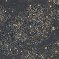 浙江美森-人iPSC （健康人）Human iPS Cell Line (Normal)