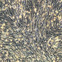 浙江美森-人胚肺成纤维细胞 MRC-5