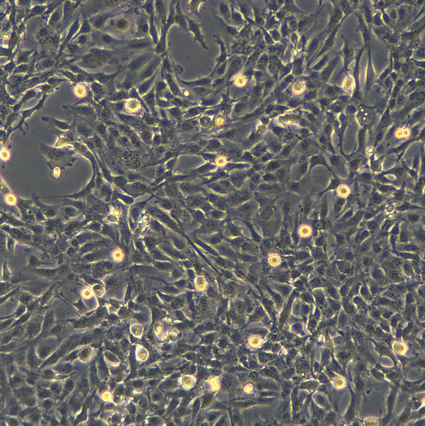 浙江美森-永生化人子宫内膜异位症细胞(12Z) 12Z