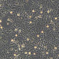 浙江美森-永生化人子宫内膜异位症细胞（12Z) 12Z