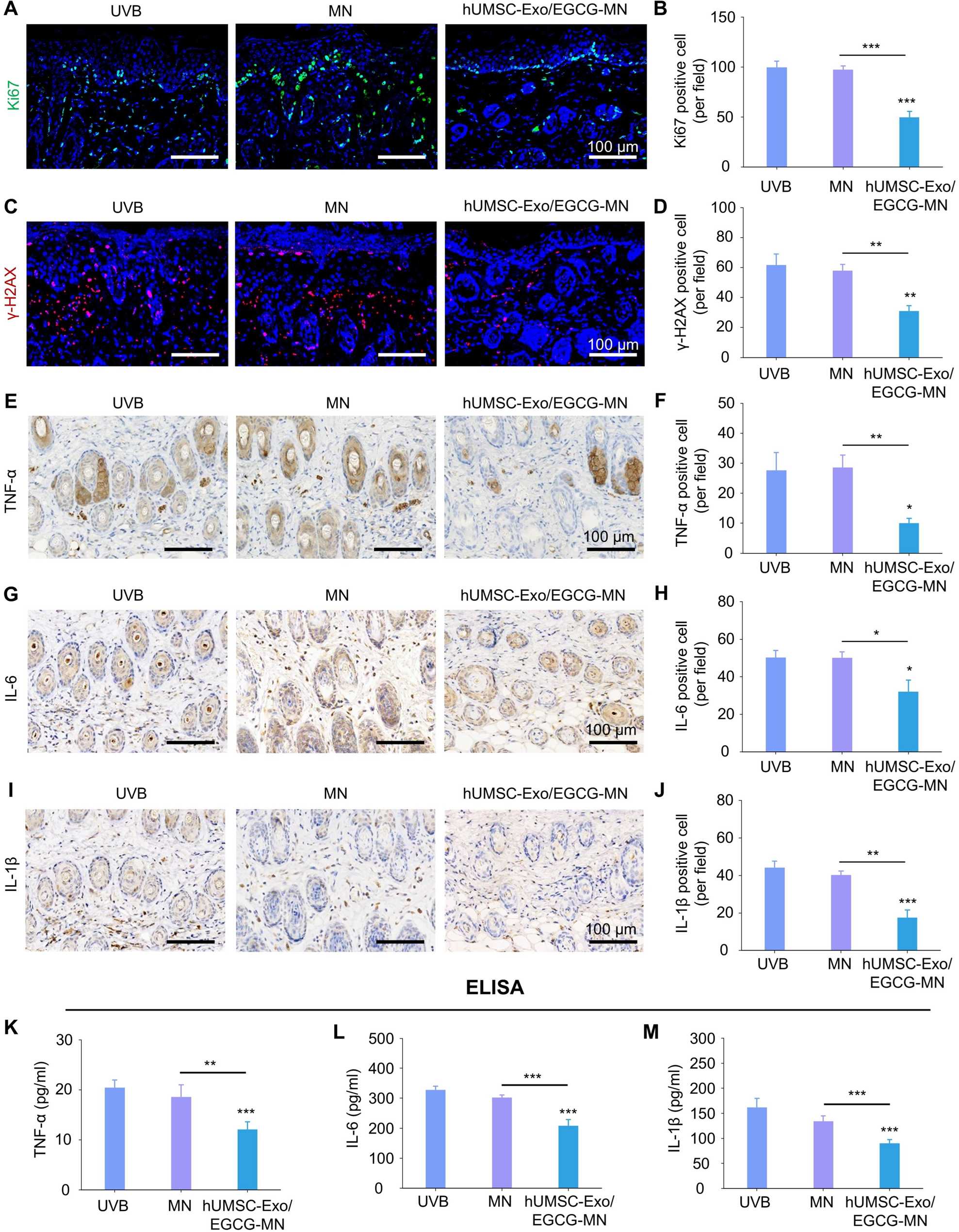 IF=12.6 | Umibio外泌体红色荧光标记染料助力客户紫外线诱导的皮肤损伤研究!