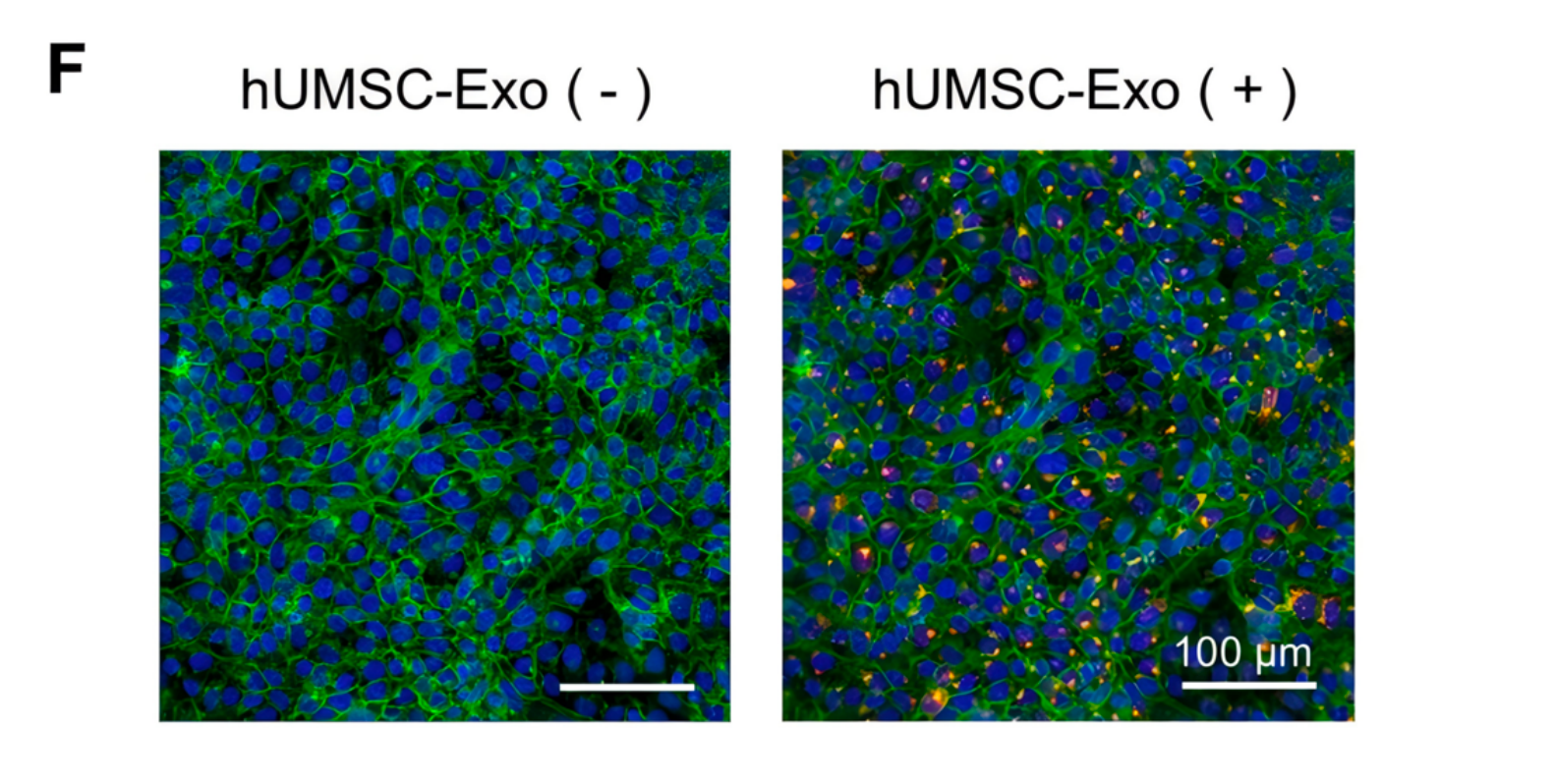 IF=12.6 | Umibio外泌体红色荧光标记染料助力客户紫外线诱导的皮肤损伤研究!