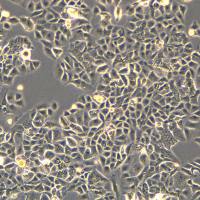 浙江美森-人肝癌亚历山大细胞 PLC-PRF-5