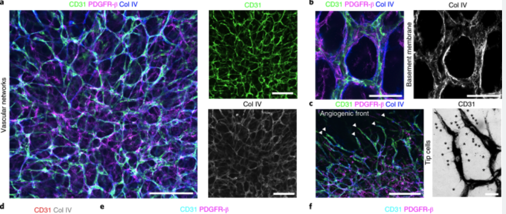 为什么类器官养不大？？？