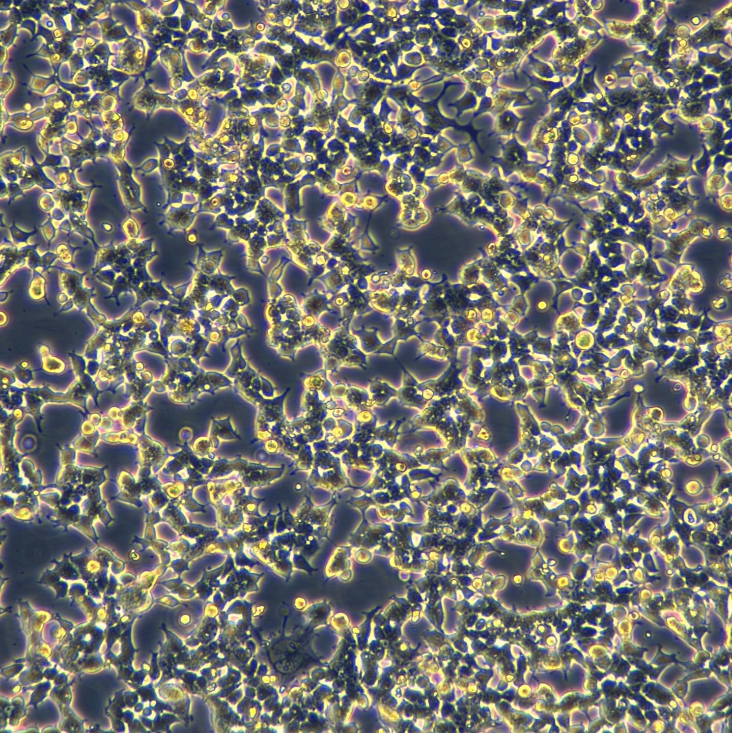 浙江美森-外源表达人源ACE2, 带有Puro抗性 293T-ACE2