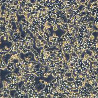 浙江美森-外源表达人源ACE2, 带有Puro抗性 293T-ACE2