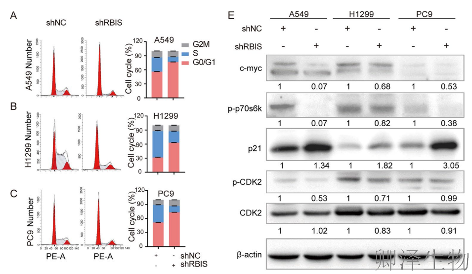 【客户案例重温】RBIS如何通过调控核糖体合成驱动肺癌进展与化疗耐药