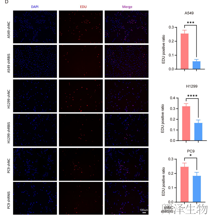 【客户案例重温】RBIS如何通过调控核糖体合成驱动肺癌进展与化疗耐药