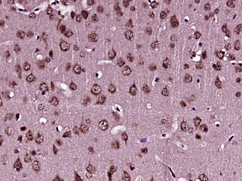 TMX3 Rabbit Polyclonal Antibod