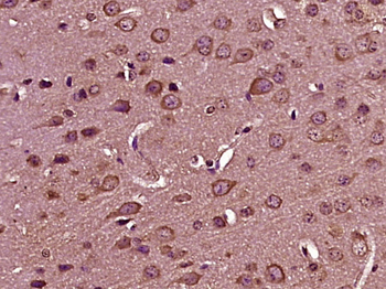 LARP4B/LARP5 Rabbit Polyclonal