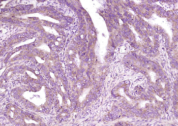 CD4 Rabbit Polyclonal Antibody