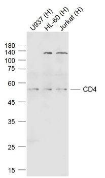 CD4 Rabbit Polyclonal Antibody