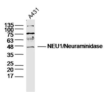 NEU1/Neuraminidase Rabbit Poly