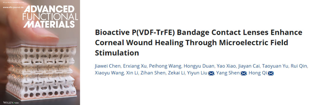 【10月文献战报】Bioss 抗体新增高分文献精彩呈现