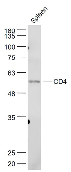 CD4 Rabbit Polyclonal Antibody
