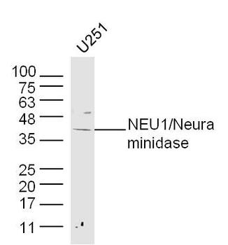 NEU1/Neuraminidase Rabbit Poly