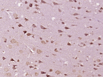 KIFAP3 Rabbit Polyclonal Antib