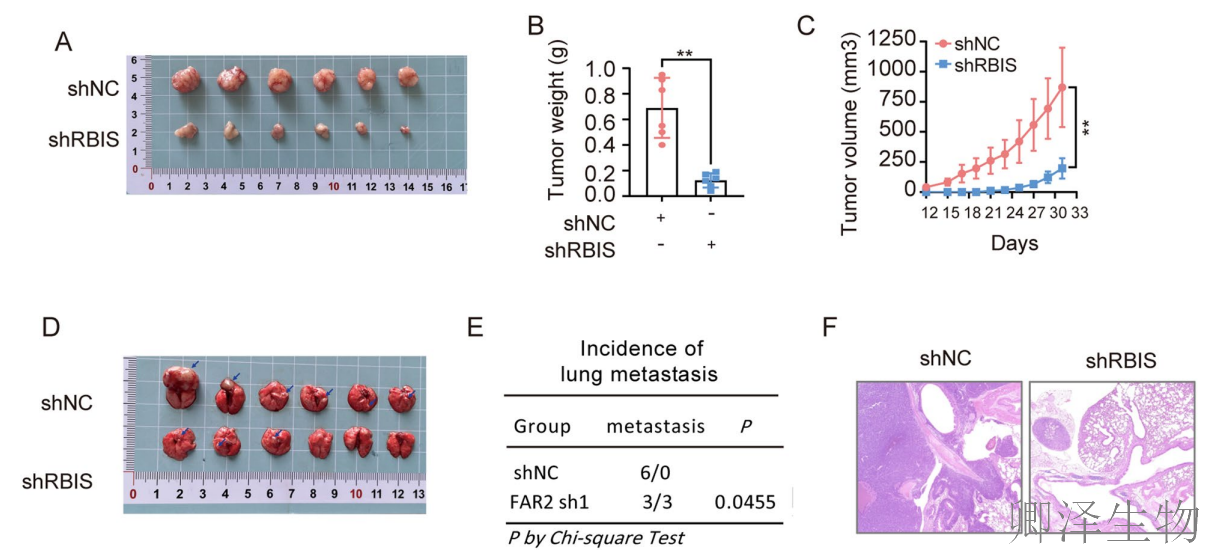【客户案例重温】RBIS如何通过调控核糖体合成驱动肺癌进展与化疗耐药