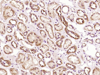 PLA2R Rabbit Polyclonal Antibo