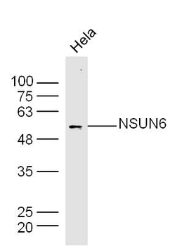 NSUN6 Rabbit Polyclonal Antibo