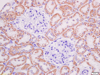 AGEs Rabbit Polyclonal Antibod