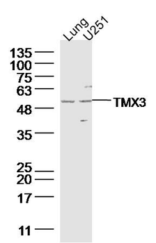 TMX3 Rabbit Polyclonal Antibod