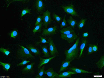 Phospho-AKT1 (Ser129) Rabbit P