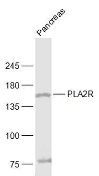 PLA2R Rabbit Polyclonal Antibo