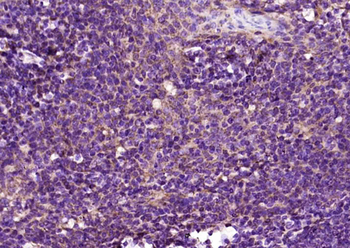 CD4 Rabbit Polyclonal Antibody