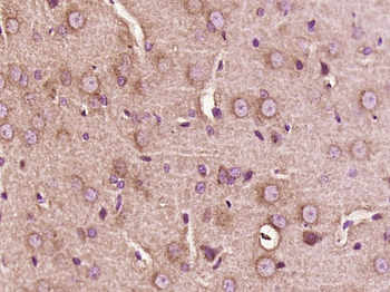 Phospho-NFKB1 (Ser373) Rabbit 