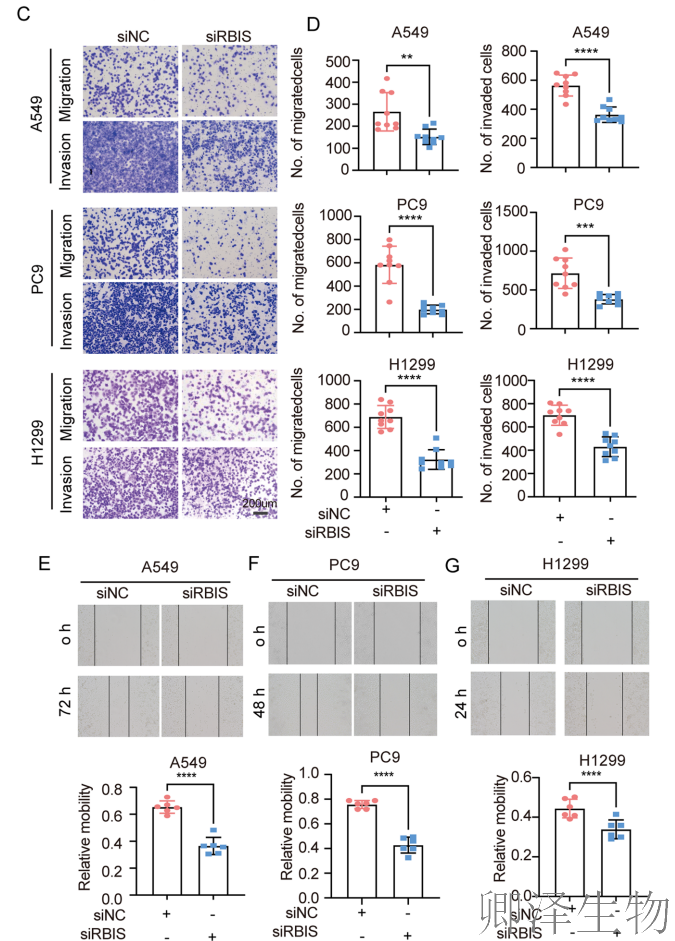 【客户案例重温】RBIS如何通过调控核糖体合成驱动肺癌进展与化疗耐药
