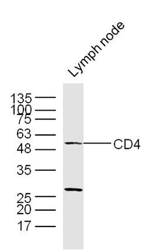 CD4 Rabbit Polyclonal Antibody