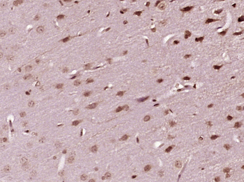 PNRC2 Rabbit Polyclonal Antibo