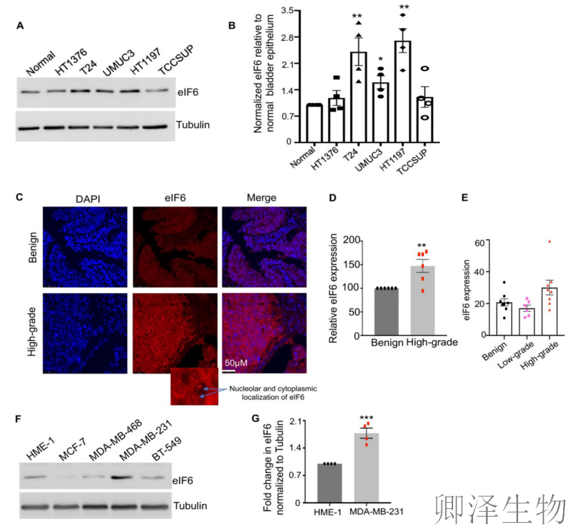 【核糖体调控蛋白】 | 癌细胞刹车失灵！eIF6如何引发癌症“连环车祸”？