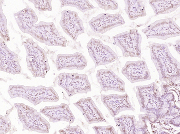 ESCO2 Rabbit Polyclonal Antibo