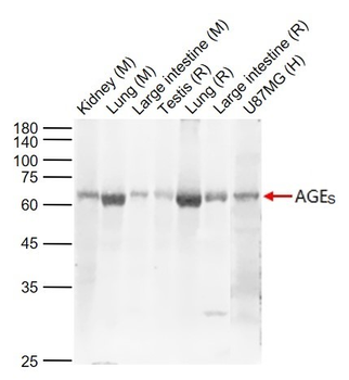 AGEs Rabbit Polyclonal Antibod
