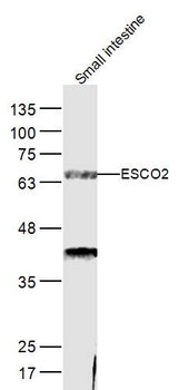 ESCO2 Rabbit Polyclonal Antibo
