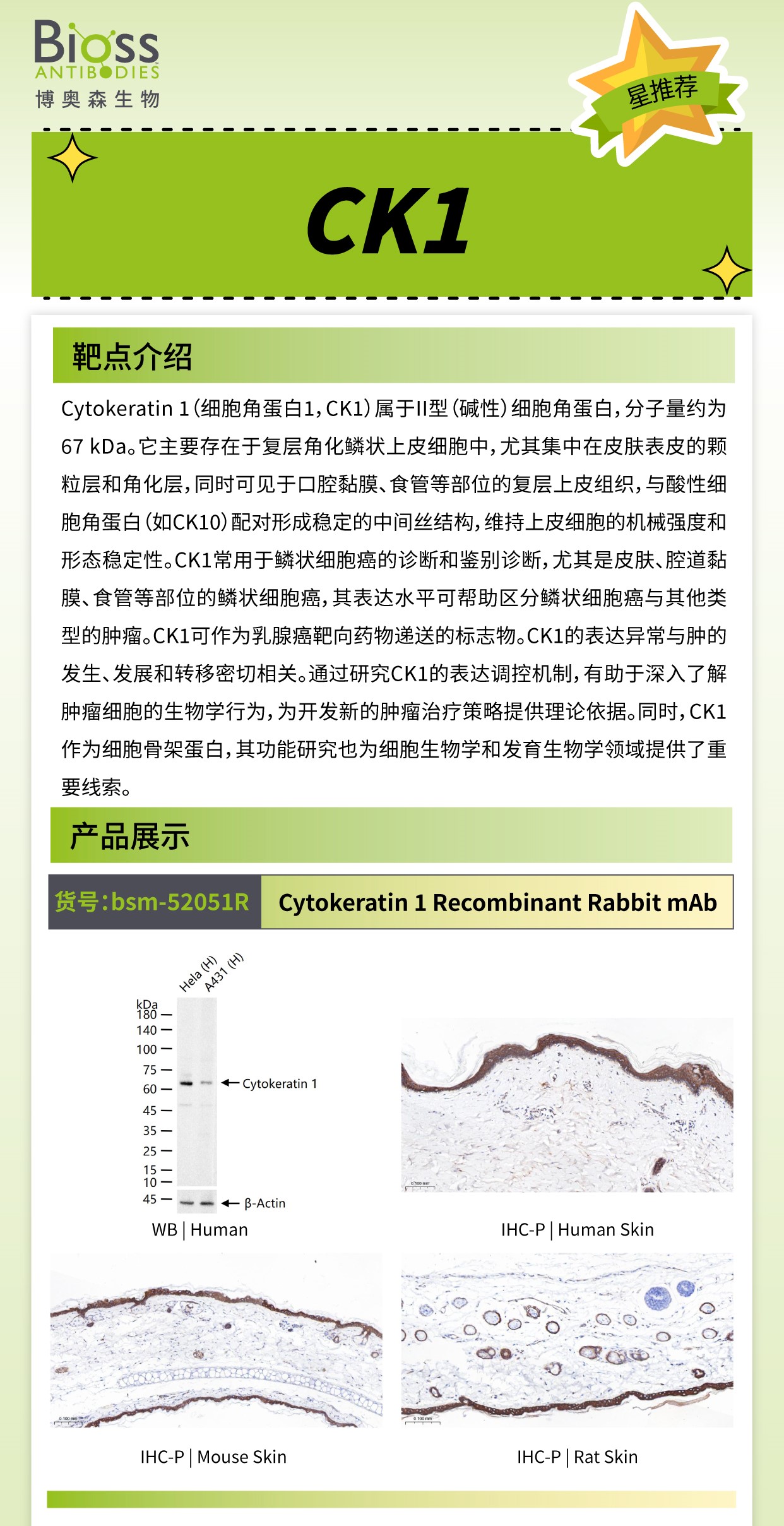 Bioss 星推荐 | CK1 抗体