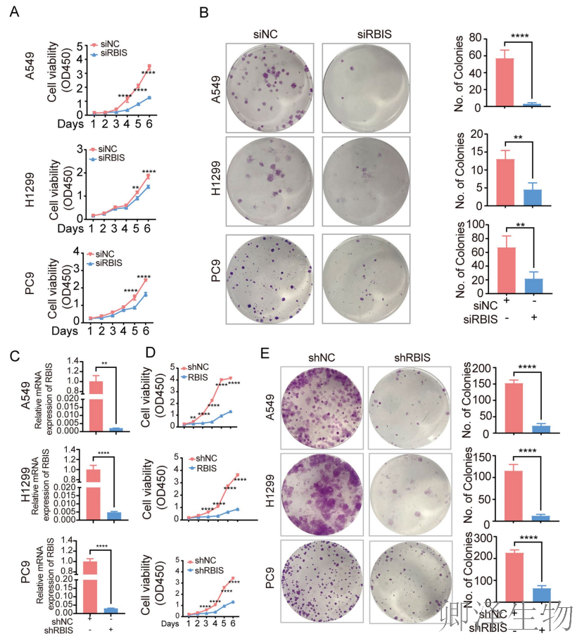 【客户案例重温】RBIS如何通过调控核糖体合成驱动肺癌进展与化疗耐药
