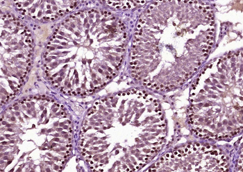 BNC1 Rabbit Polyclonal Antibod