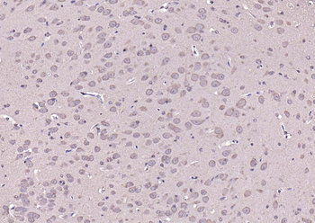 Phospho-PYK2 (Tyr402) Rabbit P