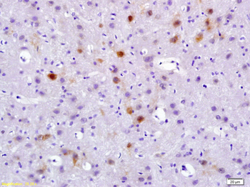 Phospho-PYK2 (Tyr402) Rabbit P