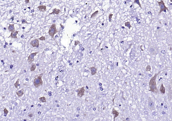 Phospho-NMDAR2A (Tyr1325) Rabb