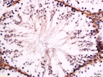 GM2A Rabbit Polyclonal Antibod