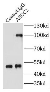ASCC2 Antibody抗体，orb624901，bio