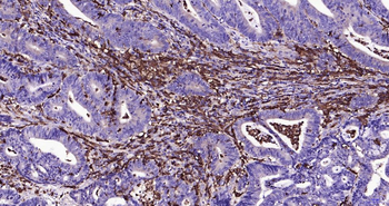 AIF1 Recombinant Rabbit Monocl