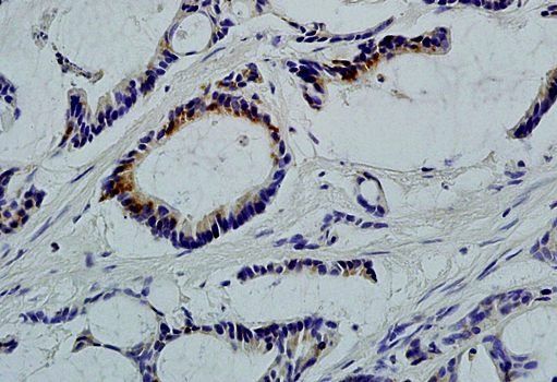 LLGL1 Rabbit Polyclonal Antibo