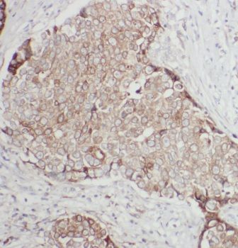 ANKRD26 Antibody抗体,orb624714,b