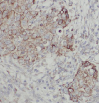 CHKA Antibody抗体,orb394875,bior